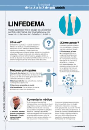 Linfedema