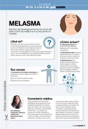 Melasma