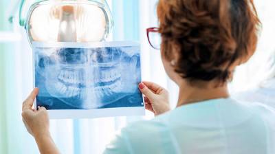 Ortopantomografía: Imagen panorámica de tu boca