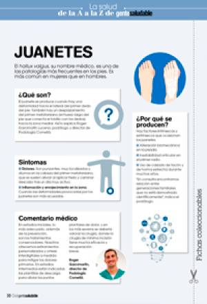 Juanetes