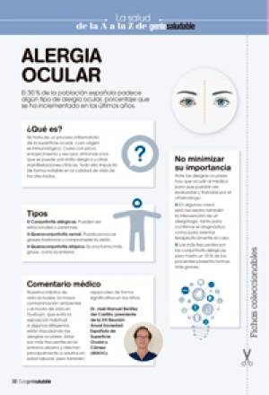 Alergia Ocular