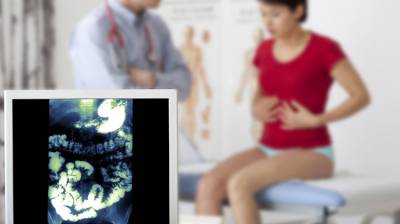 Colonoscopia: Prevenir el cáncer de colon